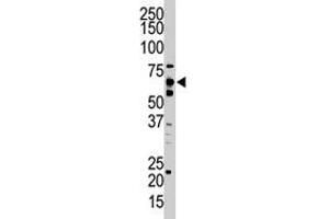 The UBQLN2 polyclonal antibody  is used in Western blot to detect UBQLN2 in HeLa cell lysate. (Ubiquilin 2 抗体  (C-Term))