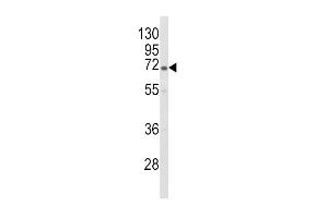 Western blot analysis of GBE1 Antibody (Center) (ABIN653459 and ABIN2842890) in HL-60 cell line lysates (35 μg/lane). (GBE1 抗体  (AA 527-556))