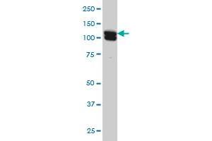 HCAP-G monoclonal antibody (M01), clone 4B1 Western Blot analysis of HCAP-G expression in HeLa . (NCAPG 抗体  (AA 336-435))