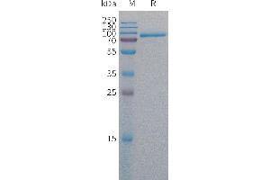 SDS-PAGE (SDS) image for Antigen P97 (Melanoma Associated) Identified By Monoclonal Antibodies 133.2 and 96.5 (MFI2) (AA 20-708) protein (His tag) (ABIN7538133)