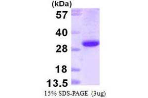 Ephrin B1 Protein (EFNB1) (AA 28-237) (His tag)