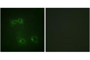Immunofluorescence analysis of COS7 cells, using FAS (Phospho-Tyr291) Antibody. (FAS 抗体  (pTyr291))