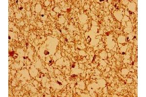 Immunohistochemistry of paraffin-embedded human brain tissue using ABIN7145127 at dilution of 1:100 (AXIN2 抗体  (AA 11-77))
