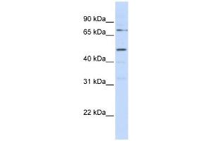 KREMEN1 antibody used at 1 ug/ml to detect target protein.