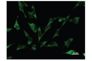 Immunostaining analysis in HeLa cells. (YARS 抗体)