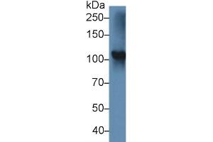 Western Blot; Sample: Rat Thyroid lysate; Primary Ab: 5µg/ml Rabbit Anti-Mouse TPO Antibody Second Ab: 0. (Thyroperoxidase 抗体  (AA 636-832))