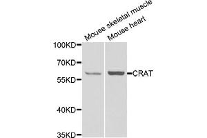 Western blot analysis of extracts of various cell lines, using Crat antibody (ABIN5973772) at 1/1000 dilution. (CRAT 抗体)