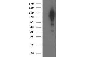 Western Blotting (WB) image for anti-Breast Cancer Anti-Estrogen Resistance 1 (BCAR1) antibody (ABIN1496833) (BCAR1 抗体)
