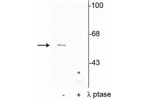 Western blot of rat cortical lysate showing specific immunolabeling of the ~62 kDa synaptotagmin phosphorylated at Thr202 in the first lane (-). (SYT1 抗体  (pSer309))