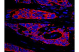 Immunohistochemistry (IHC) image for anti-serine threonine Kinase 39 (STK39) (AA 425-450) antibody (ABIN7448809) (STK39 抗体  (AA 425-450))