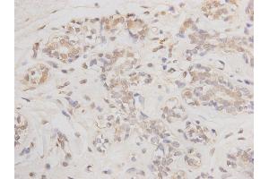 Immunohistochemistry (Paraffin-embedded Sections) (IHC (p)) image for anti-B-Cell CLL/lymphoma 2 (BCL2) antibody (ABIN5557347)