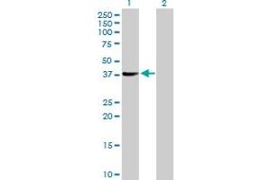 Western Blotting (WB) image for anti-SGT1, Suppressor of G2 Allele of SKP1 (SUGT1) (AA 1-333) antibody (ABIN524314)