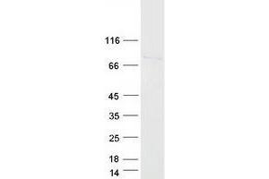 Western Blotting (WB) image for Urocanate Hydratase 1 (UROC1) protein (Myc-DYKDDDDK Tag) (ABIN2735071)