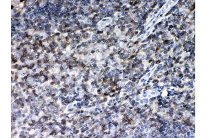 Immunohistochemistry (IHC) image for anti-Macrophage Migration Inhibitory Factor (Glycosylation-Inhibiting Factor) (MIF) (AA 2-115) antibody (ABIN3043878)