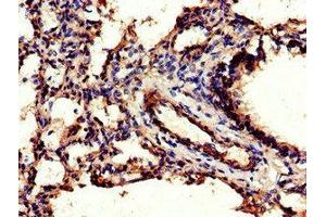 Immunohistochemistry of paraffin-embedded human lung tissue using ABIN7147080 at dilution of 1:100 (CEBPB 抗体  (AA 41-270))