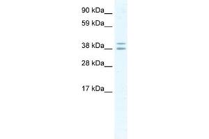 TSG101 antibody (20R-1186) used at 0. (TSG101 抗体  (Middle Region))