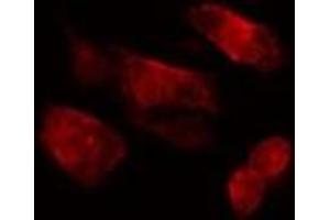 ABIN6275535 staining  HepG2 cells by IF/ICC. (PLK3 抗体  (Internal Region))