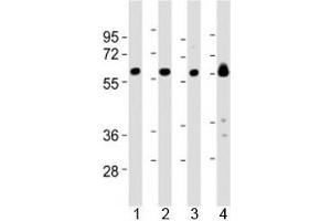 Western blot testing of Lyn antibody at 1:2000 dilution and mouse samples: Lane 1: kidney lysate; 2: heart lysate; 3: ovary lysate; 4: skeletal muscle lysate; Predicted molecular weight 56/58 kDa (isoforms 1/2). (LYN 抗体  (AA 229-263))
