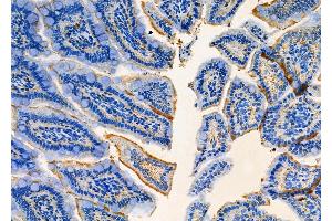 ABIN6263053 and ABIN6277856 at 1/100 staining Mouse colorectal tissue by IHC-P.