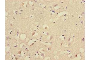 Immunohistochemistry of paraffin-embedded human brain tissue using ABIN7174506 at dilution of 1:100 (UBE2Z 抗体  (AA 115-354))
