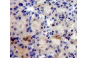 Used in DAB staining on fromalin fixed paraffin-embedded kidney tissue (ANGPTL4 抗体  (AA 182-394))