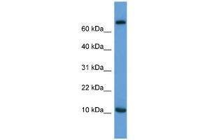WB Suggested Anti-Ccl20 Antibody Titration:  0. (CCL20 抗体  (C-Term))