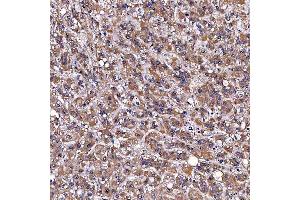 IHC analysis of TOMM34 using anti-TOMM34 antibody (ABIN7599253).