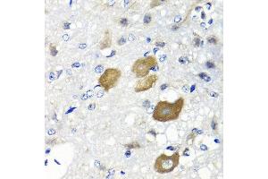 Immunohistochemistry of paraffin-embedded rat brain using IFNL1 antibody at dilution of 1:100 (40x lens). (IL29 抗体)