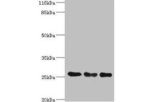 Western blot All lanes: TFAM antibody at 8 μg/mL Lane 1: Jurkat whole cell lysate Lane 2: MCF-7 whole cell lysate Lane 3: A431 whole cell lysate Secondary Goat polyclonal to rabbit IgG at 1/10000 dilution Predicted band size: 30, 26 kDa Observed band size: 26 kDa (TFAM 抗体  (AA 43-246))