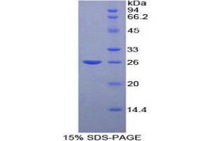 SDS-PAGE (SDS) image for Fibulin 2 (FBLN2) (AA 896-1106) protein (His tag) (ABIN1981122)