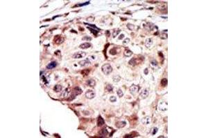 Image no. 1 for anti-RYK Receptor-Like Tyrosine Kinase (RYK) (AA 150-200) antibody (ABIN359937) (RYK 抗体  (AA 150-200))
