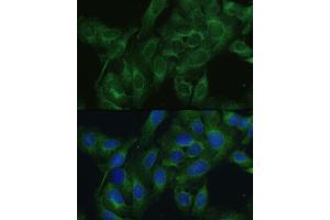 Immunofluorescence analysis of U2OS cells using FRMD6 antibody (ABIN6132194, ABIN6140773, ABIN6140774 and ABIN6225347) at dilution of 1:100.
