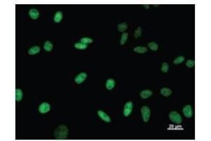 Immunostaining analysis in HeLa cells. (TCERG1 抗体)