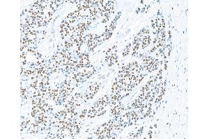 Immunohistochemistry (IHC) image for anti-Poly (ADP-Ribose) Polymerase 1 (PARP1) (AA 750-800) antibody (ABIN7449457)