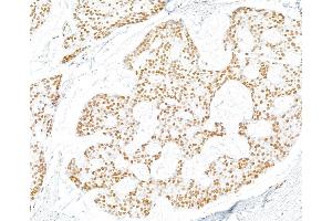 Immunohistochemistry (IHC) image for anti-gamma Histone Variant H2AX (GAMMA-H2AX) (Ser140) antibody (ABIN7455200) (Recombinant gamma H2AX 抗体  (Ser140))