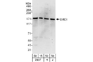 Western Blotting (WB) image for anti-Structural Maintenance of Chromosomes 1A (SMC1A) (AA 1183-1233) antibody (ABIN7454968) (SMC1A 抗体  (AA 1183-1233))