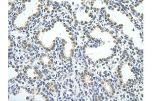 Rabbit Anti-HNRPAB antibody         Paraffin Embedded Tissue:  Human Lung    cell Cellular Data:  alveolar cell    Antibody Concentration:  4. (HNRNPAB 抗体  (C-Term))