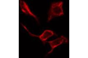 ABIN6274622 staining Hela cells by IF/ICC. (COL4a2 抗体  (N-Term))
