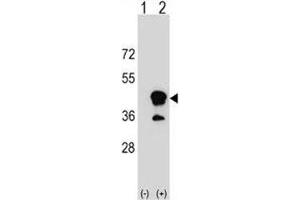 Western blot analysis of CD1b antibody and 293 cell lysate (2 ug/lane) either nontransfected (Lane 1) or transiently transfected (2) with the CD1B gene. (CD1b 抗体  (AA 57-85))
