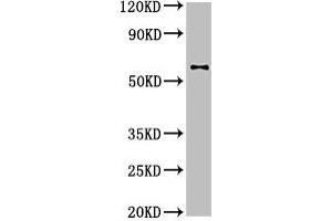 Western Blot Positive WB detected in: U87 whole cell lysate All lanes: DPYSL2 antibody at 4 μg/mL Secondary Goat polyclonal to rabbit IgG at 1/50000 dilution Predicted band size: 63, 59 kDa Observed band size: 63 kDa (DPYSL2 抗体  (AA 1-572))