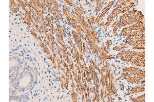 Immunohistochemistry (IHC) image for anti-Actin, alpha 2, Smooth Muscle, Aorta (ACTA2) (N-Term) antibody (ABIN6254917)