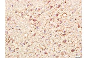 Paraformaldehyde-fixed, paraffin embedded rat brain tissue, Antigen retrieval by boiling in sodium citrate buffer(pH6) for 15min, Block endogenous peroxidase by 3% hydrogen peroxide for 30 minutes, Blocking buffer (normal goat serum) at 37°C for 20min, Antibody incubation with Rabbit Anti-PI3KCA Polyclonal Antibody, Unconjugated  at 1:400 overnight at 4°C, followed by a conjugated secondary and DAB staining (PIK3CA 抗体  (AA 961-1068))
