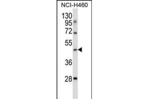 TLE6 Antibody (N-term ) (ABIN657408 and ABIN2846448) western blot analysis in NCI- cell line lysates (35 μg/lane).