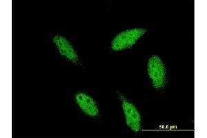 Immunofluorescence of monoclonal antibody to TBR1 on HeLa cell. (TBR1 抗体  (AA 1-108))