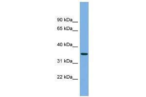 WB Suggested Anti-PRSS22 Antibody Titration: 0.