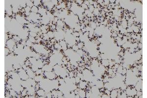 ABIN6269100 at 1/100 staining Mouse lung tissue by IHC-P. (FYN 抗体  (C-Term))