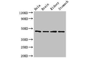 Western Blot Positive WB detected in: Hela whole cell lysate, Mouse brain tissue, Mouse kidney tissue, Mouse stomach tissue All lanes: NOB1 antibody at 1. (NOB1 抗体  (AA 103-229))