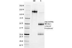 SDS-PAGE Analysis Purified MDM2 Mouse Monoclonal Antibody (SMP14). (MDM2 抗体  (AA 154-167))
