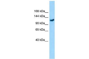 WB Suggested Anti-GMIP Antibody Titration: 1. (GMIP 抗体  (C-Term))