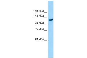 WB Suggested Anti-GMIP Antibody Titration: 1.